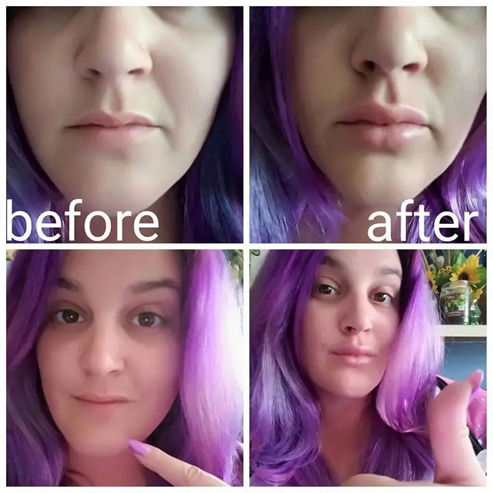 PlumpPerfect Electric Lip Enhancer